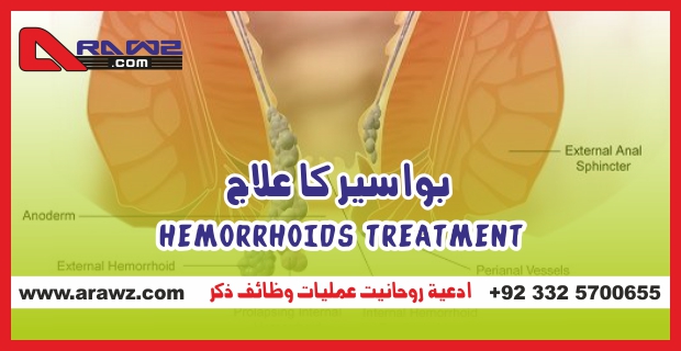 Hemorrhoids Treatment  بواسیر کا علاج