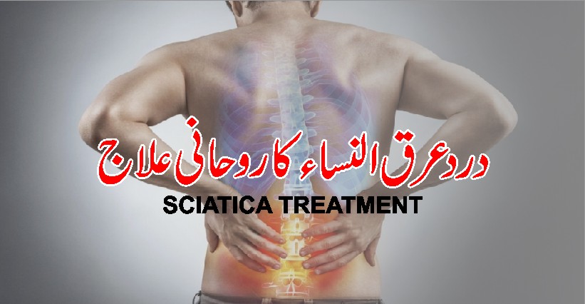 Sciatica Pain Relief | Arq Un Nisa Se Nijat Ka Wazifa